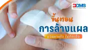 สุขภาพกายดี แผลหายไว ไม่ติดเชื้อ! ขั้นตอนล้างแผลที่ถูกต้อง ลดอักเสบ-โอกาสเป็นหนอง