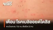 รัฐบาลเตือนเฝ้าระวังโรคเมลิออยด์โดสิส พบผู้ป่วยสะสม 732 ราย เสียชีวิต 23 ราย