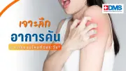 เจาะลึกอาการคัน สาเหตุและวิธีป้องกัน สัญญาณอันตรายที่ควรพบแพทย์