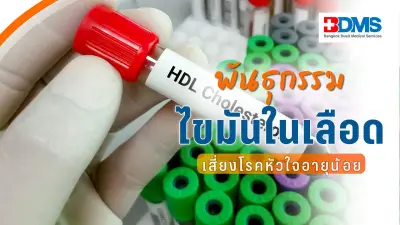 แพทย์เตือนไขมันในเลือดสูงจากพันธุกรรม เสี่ยงโรคหัวใจอายุน้อย