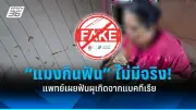 เตือนภัย! หนุ่มกินข้าวกล่อง 2 กล่องติดกัน ช็อกพบหนอนเป็นๆ ในอาหาร