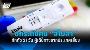 เตือนผู้สูงวัย! ระวัง 'โรคกระดูกพรุน' ภัยเงียบที่มองไม่เห็น