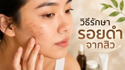 ดีเดย์ 8 พ.ค. 68 เปิดชำระหนี้ กยศ. ก่อนกำหนด รับส่วนลดดอกเบี้ยสูงสุด 50%