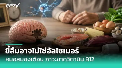 พบยีนกลายพันธุ์เชื่อมโยงโรคอ้วนเสี่ยงเบาหวานและหัวใจ