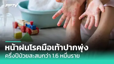 นอนไม่หลับเสี่ยงโรคหัวใจและหลอดเลือด แพทย์แนะวิธีปรับพฤติกรรม