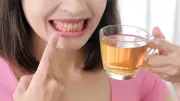 10 อาหารในชีวิตประจำวัน สาเหตุทำฟันเหลืองโดยไม่รู้ตัว