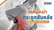 สัญญาณโรคกระดูกสันหลังที่ควรผ่าตัด เทคนิคผ่าแผลเล็ก ลดเจ็บ ฟื้นตัวไว