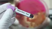 แพทยสภาเตือนไวรัสอีโบลาระบาดในคองโก-ยูกันดา แนะเฝ้าระวังเข้ม