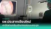 พบผู้ป่วยไข้หวัดนก H5N1 รายแรกในเม็กซิโก เสียชีวิต