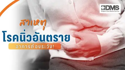 โรคนิ่วทางเดินปัสสาวะ ภัยเงียบที่ควรรู้ สาเหตุ อาการ และการป้องกัน